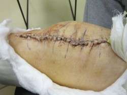 Staples In